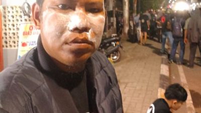 Demi Tugas Jurnalistik di Tengah Ricuh dan Gas Air Mata, Ricky Bertahan dengan Odol